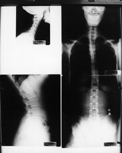 X-rays for patient safety